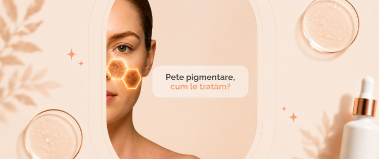 PETE PIGMENTARE, CUM LE TRATAM CU AJUTORUL PRODUSELOR COSMETICE?