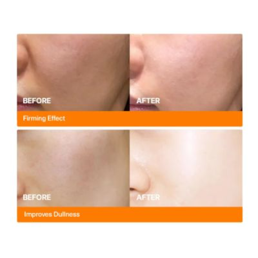 Ser concentrat cu PDRN