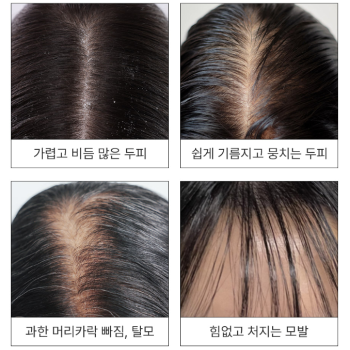 Tonic pentru scalp pentru densitate și revitalizare