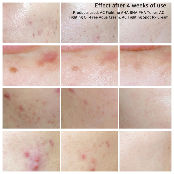 Crema anti-inflamatorie