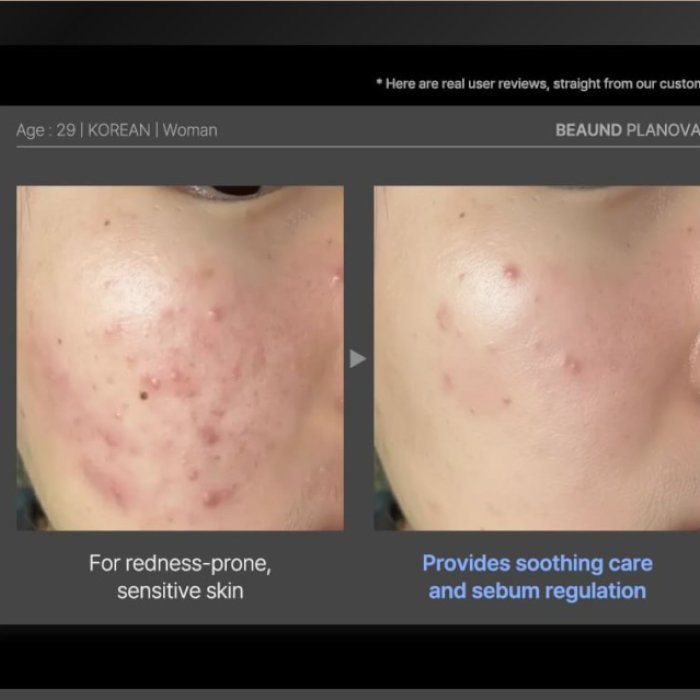 Dispozitiv facial cu tehnologie Cold Plasma pentru îngrijirea pielii