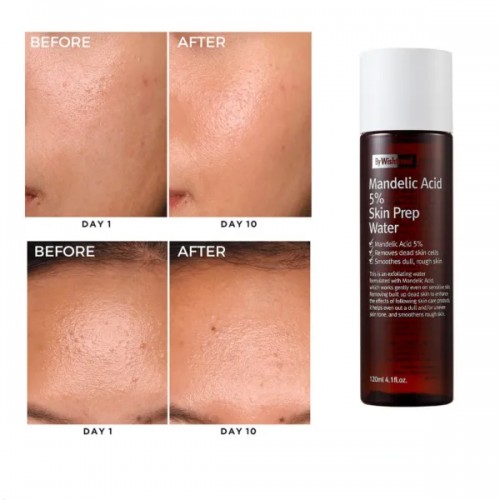 Toner exfoliant bland cu acid mandelic 30 ml